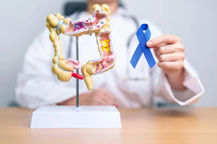 doctor holding blue ribbon with human colon anatomy model march colorectal cancer 1332293 845